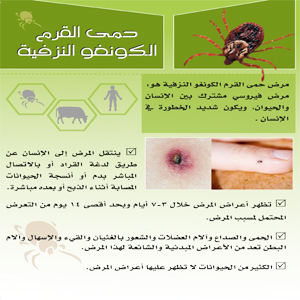 Crimean Congo Haemorrhagic Fever (by Arabic Languge)