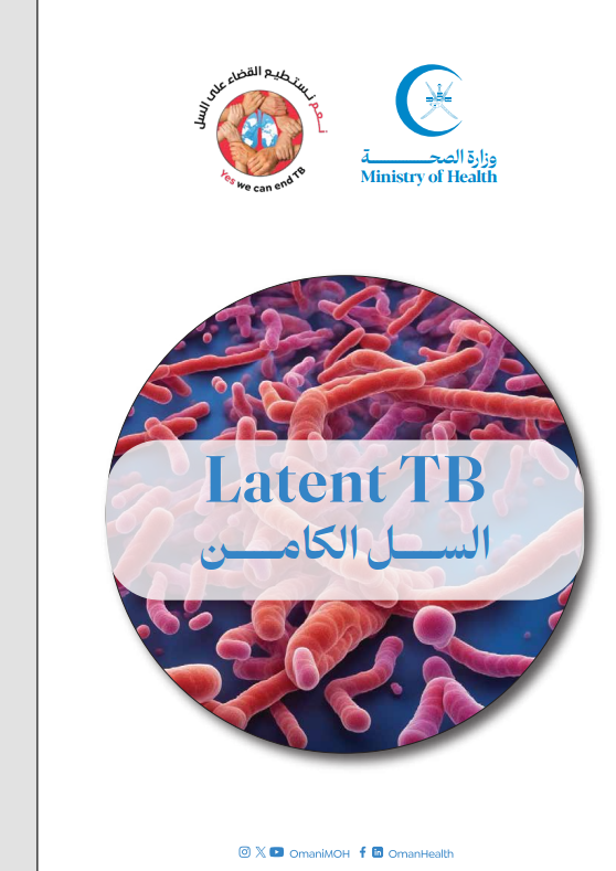 السل الكامن