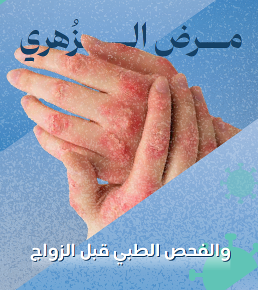 نشرة مرض الزهري